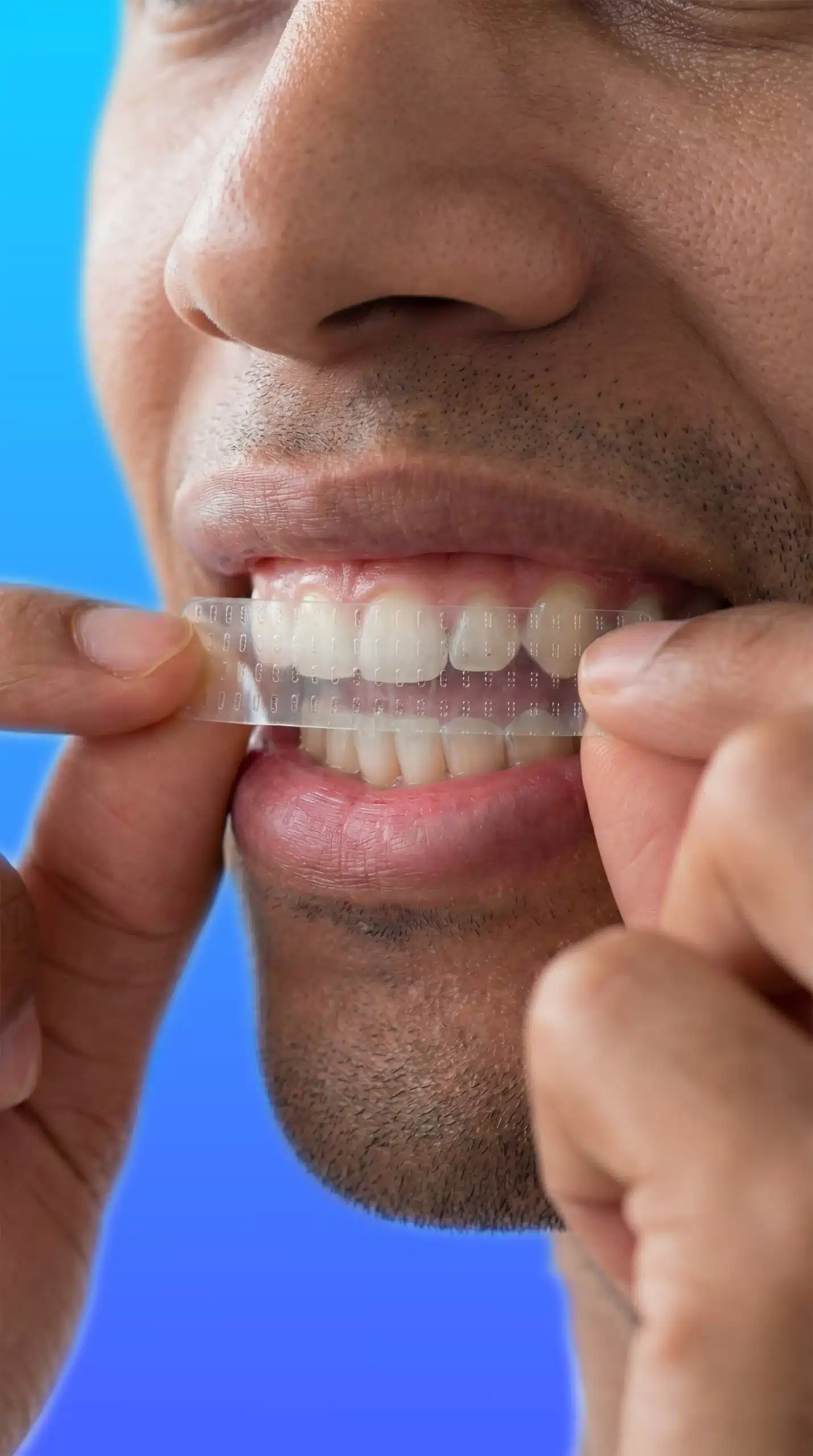 Applying an OraCare White teeth-whitening strip
